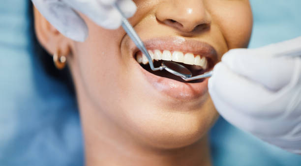 Best Urgent Tooth Repair  in Plover, WI