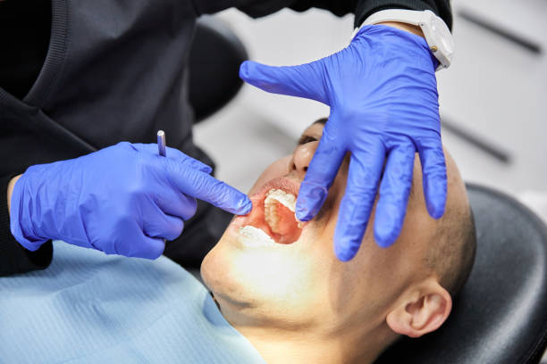 Best Chipped Tooth Repair Near Me  in Plover, WI